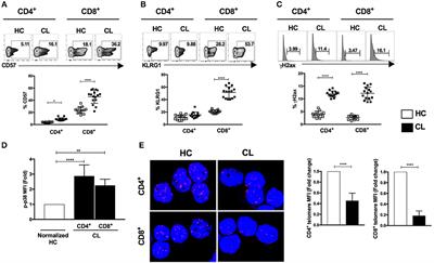 Circulating Senescent T Cells Are Linked to Systemic Inflammation and Lesion Size During Human Cutaneous Leishmaniasis